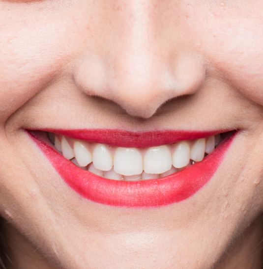 teeth whitening treatment