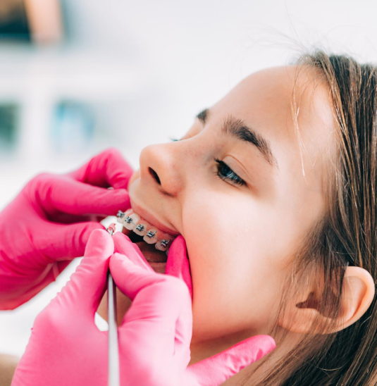 Dental braces treatment inCalicut