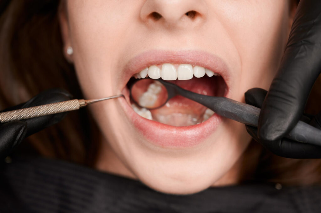 gum contouring treatment