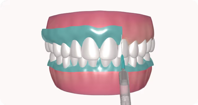 Teeth cleaning in teeth whitening treatment