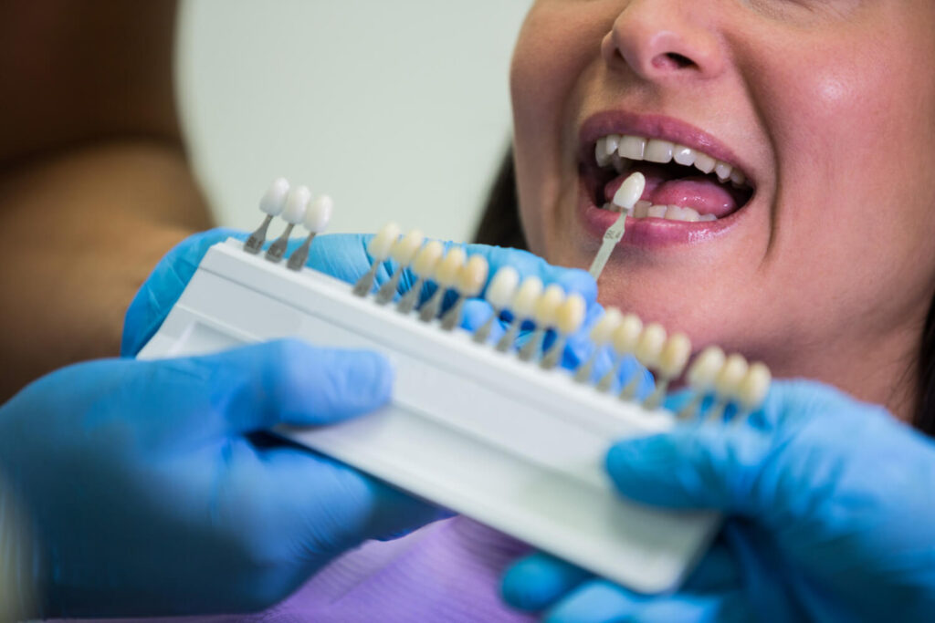 tooth prepration